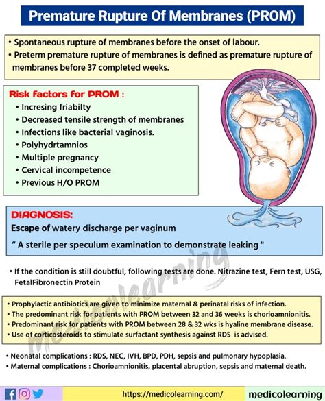 Premature Rupture of Membranes: Causes & Treatment